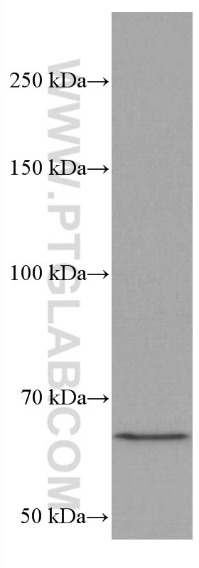 Western Blot (WB) analysis of Jurkat cells using MALT1 Monoclonal antibody (66225-1-Ig)