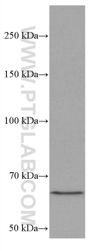 Western Blot (WB) analysis of Jurkat cells using MALT1 Monoclonal antibody (66225-1-Ig)