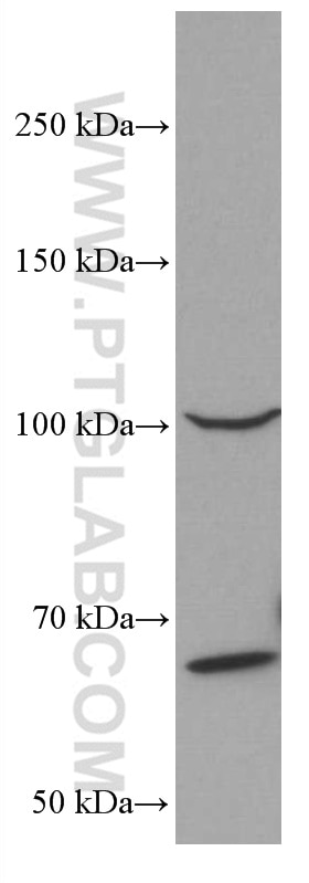 Western Blot (WB) analysis of K-562 cells using MALT1 Monoclonal antibody (66225-1-Ig)