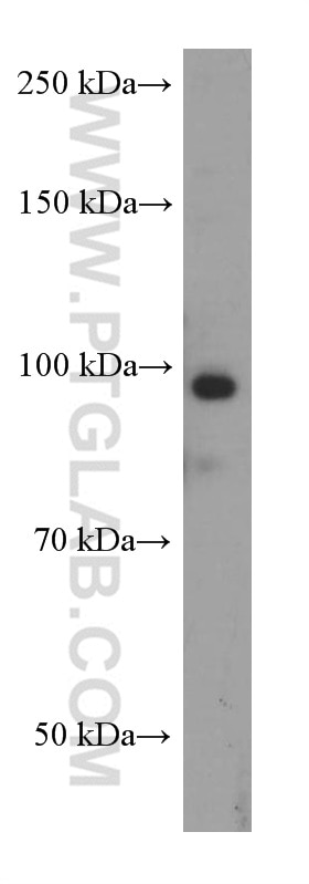 Western Blot (WB) analysis of HeLa cells using MALT1 Monoclonal antibody (66225-1-Ig)