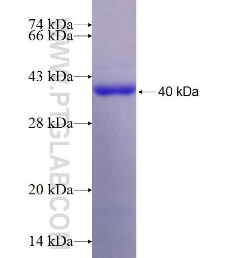 MALT1 fusion protein Ag20632 SDS-PAGE