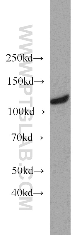 WB analysis of HEK-293 using 23263-1-AP