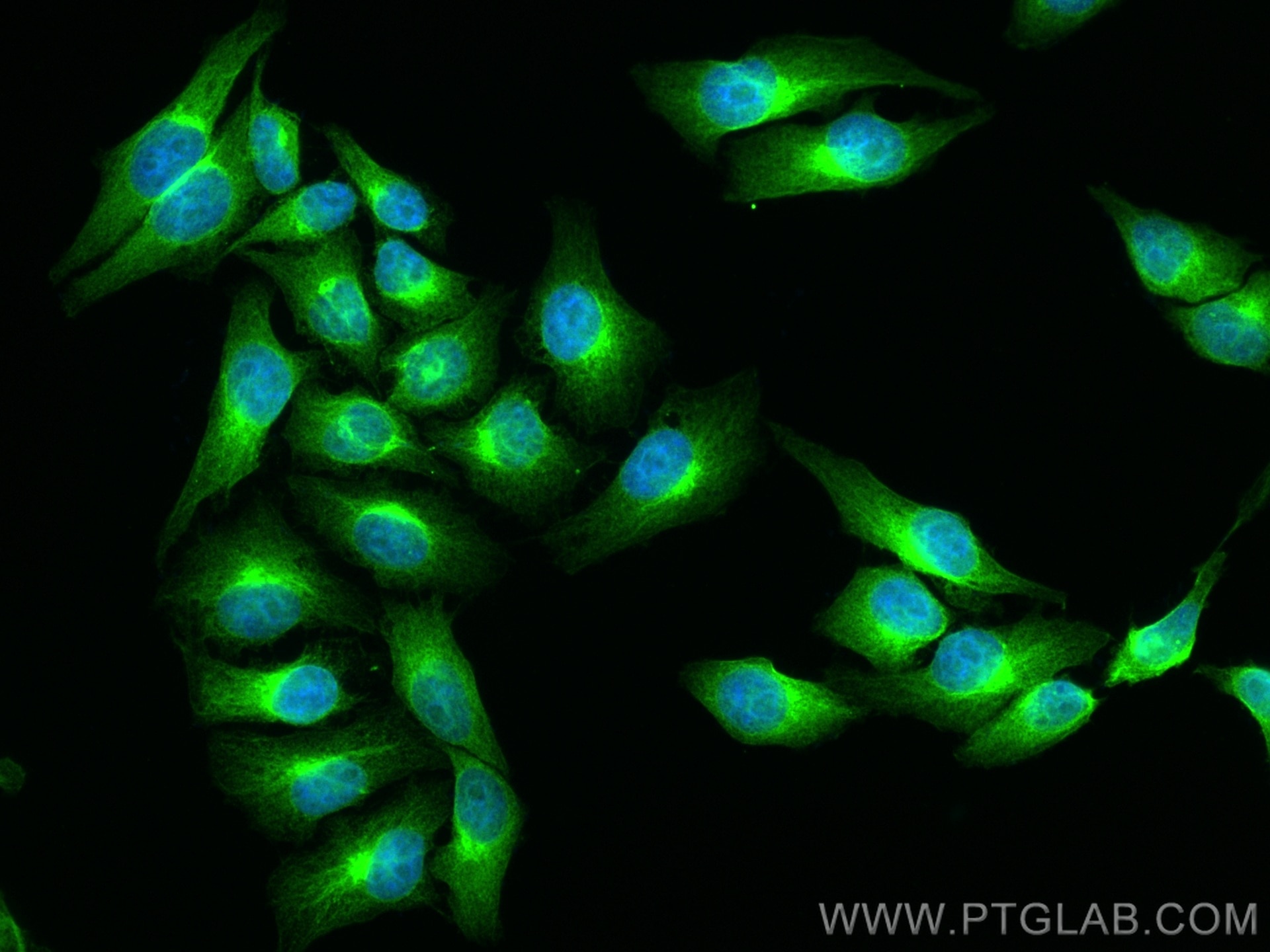 Immunofluorescence (IF) / fluorescent staining of HepG2 cells using MAN1A1 Polyclonal antibody (23382-1-AP)