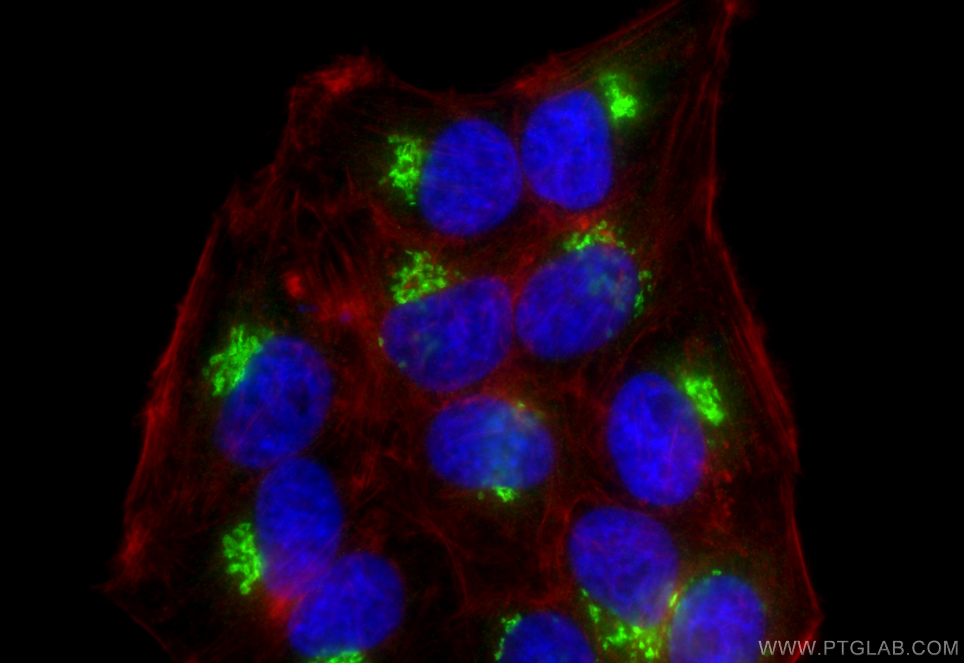 Immunofluorescence (IF) / fluorescent staining of HepG2 cells using MAN1A1 Polyclonal antibody (23382-1-AP)