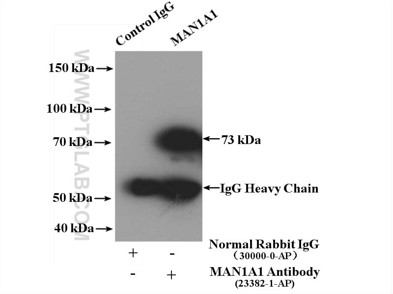 Immunoprecipitation (IP) experiment of MCF-7 cells using MAN1A1 Polyclonal antibody (23382-1-AP)