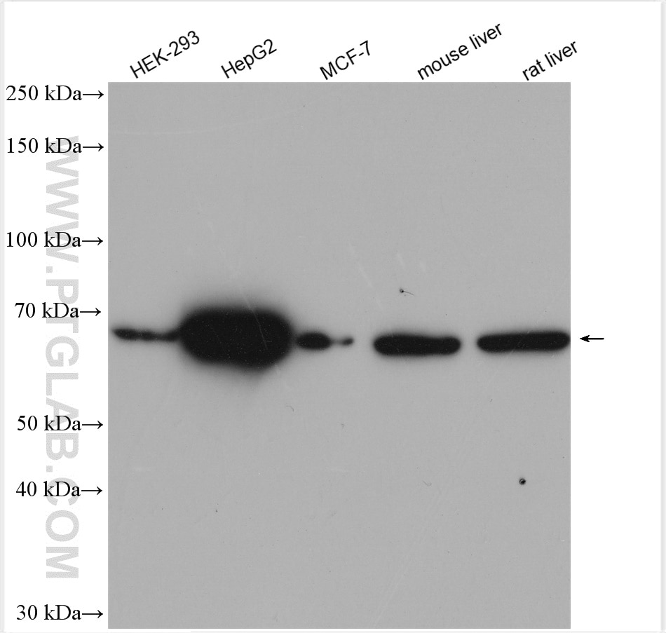 Western Blot (WB) analysis of various lysates using MAN1A1 Polyclonal antibody (23382-1-AP)