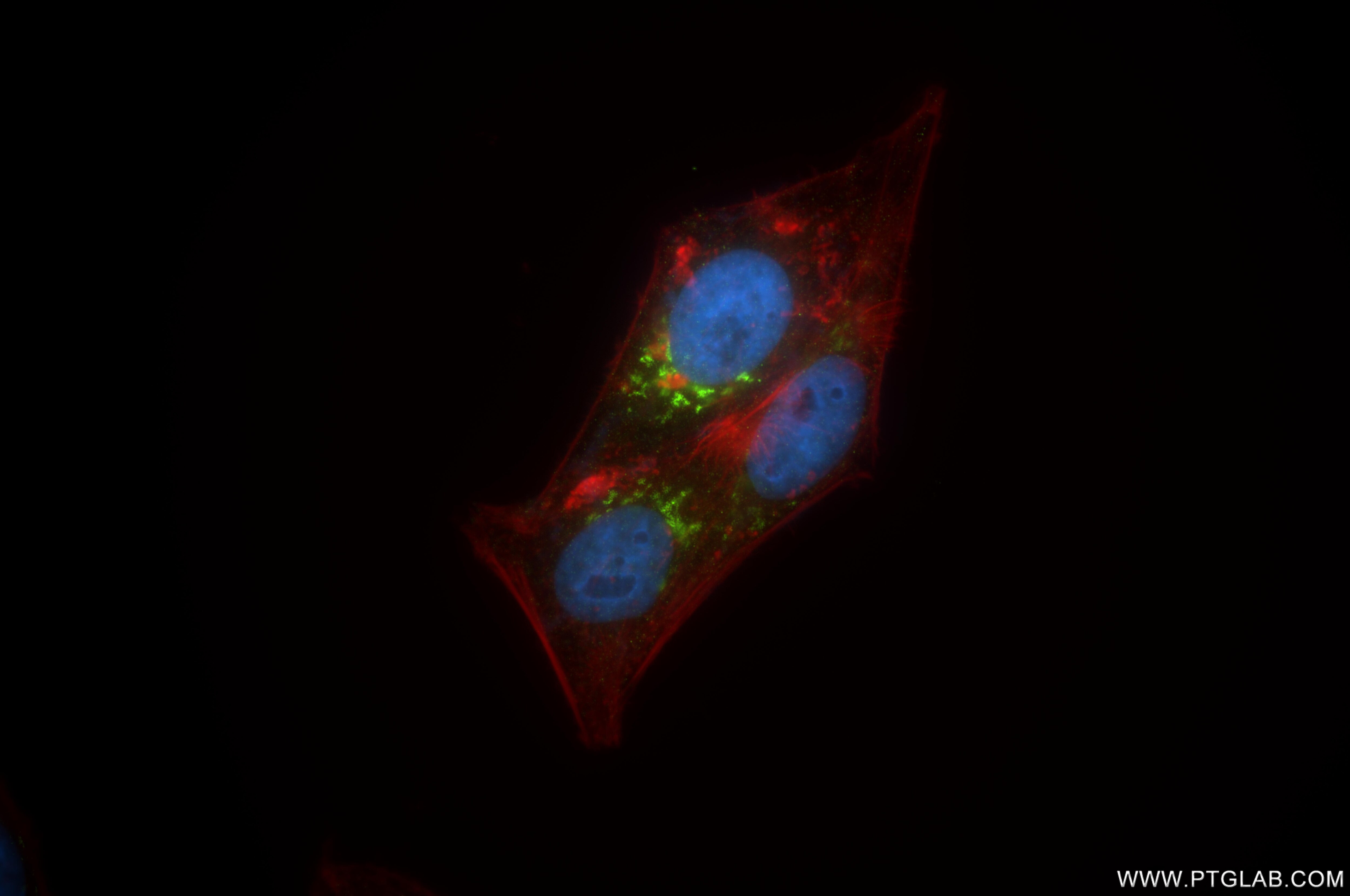 Immunofluorescence (IF) / fluorescent staining of HepG2 cells using MAN1A1 Recombinant antibody (86094-1-RR)