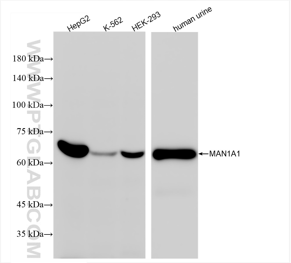 Western Blot (WB) analysis of various lysates using MAN1A1 Recombinant antibody (86094-1-RR)