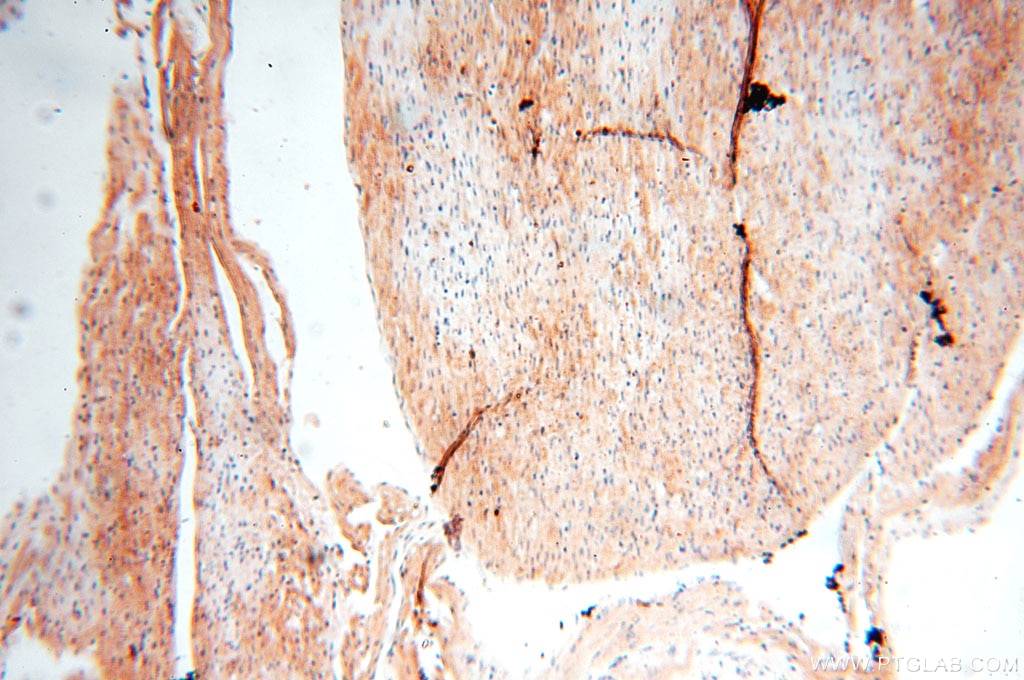 IHC staining of human heart using 14049-1-AP
