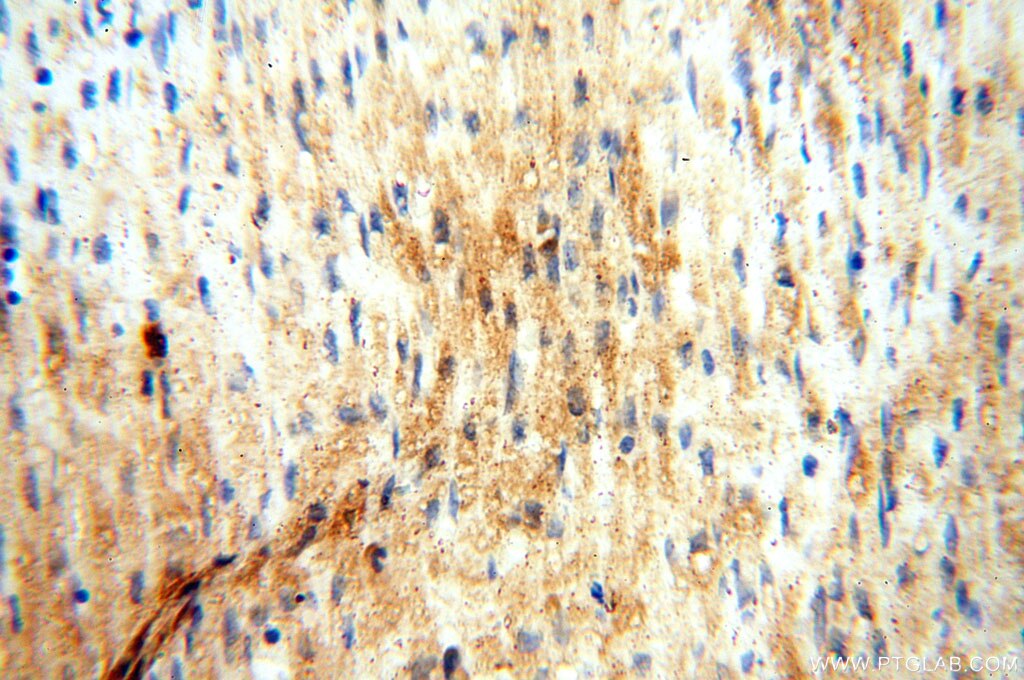 Immunohistochemistry (IHC) staining of human heart tissue using MAN1A2 Polyclonal antibody (14049-1-AP)