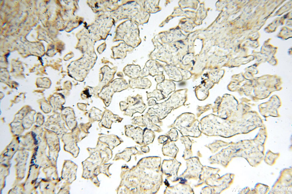 Immunohistochemistry (IHC) staining of human placenta tissue using MAN1A2 Polyclonal antibody (14049-1-AP)