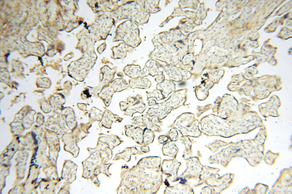 IHC staining of human placenta using 14049-1-AP