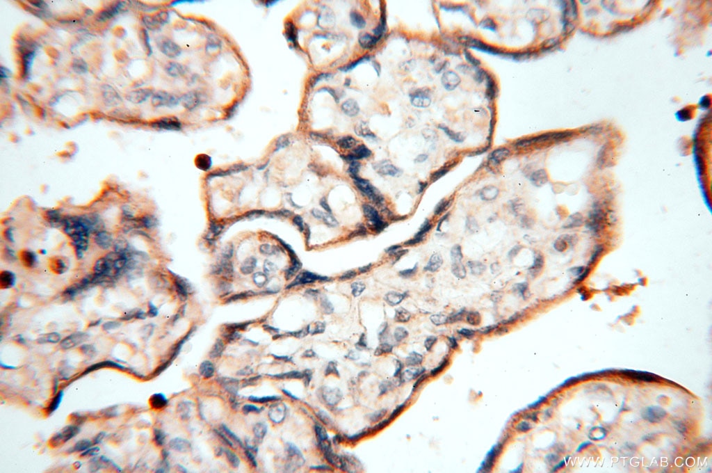 Immunohistochemistry (IHC) staining of human placenta tissue using MAN1A2 Polyclonal antibody (14049-1-AP)