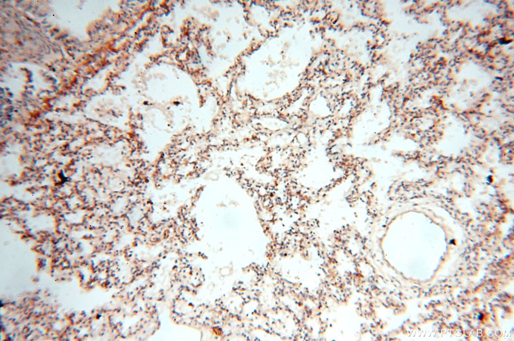 Immunohistochemistry (IHC) staining of human lung tissue using MAN1A2 Polyclonal antibody (14049-1-AP)