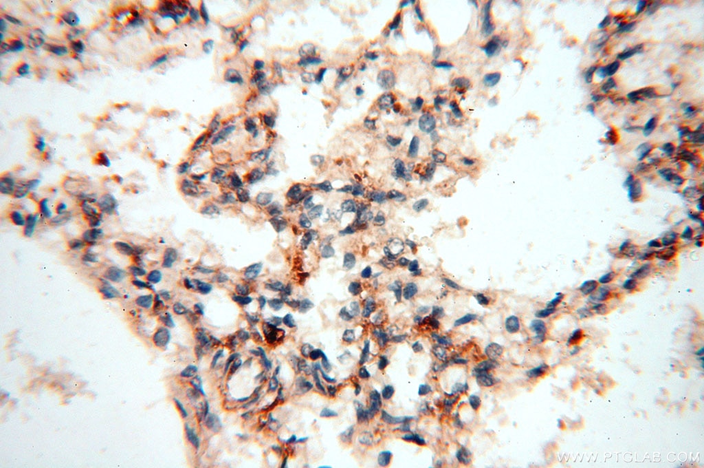 Immunohistochemistry (IHC) staining of human lung tissue using MAN1A2 Polyclonal antibody (14049-1-AP)