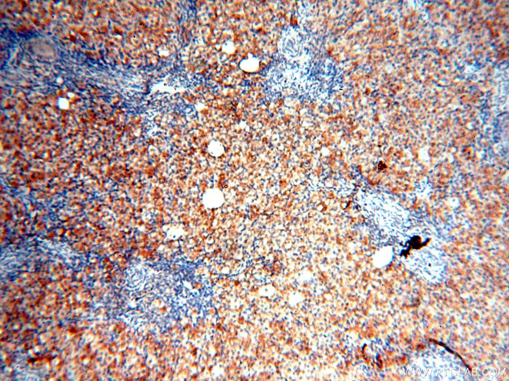 Immunohistochemistry (IHC) staining of human ovary tissue using MAN1A2 Polyclonal antibody (14049-1-AP)