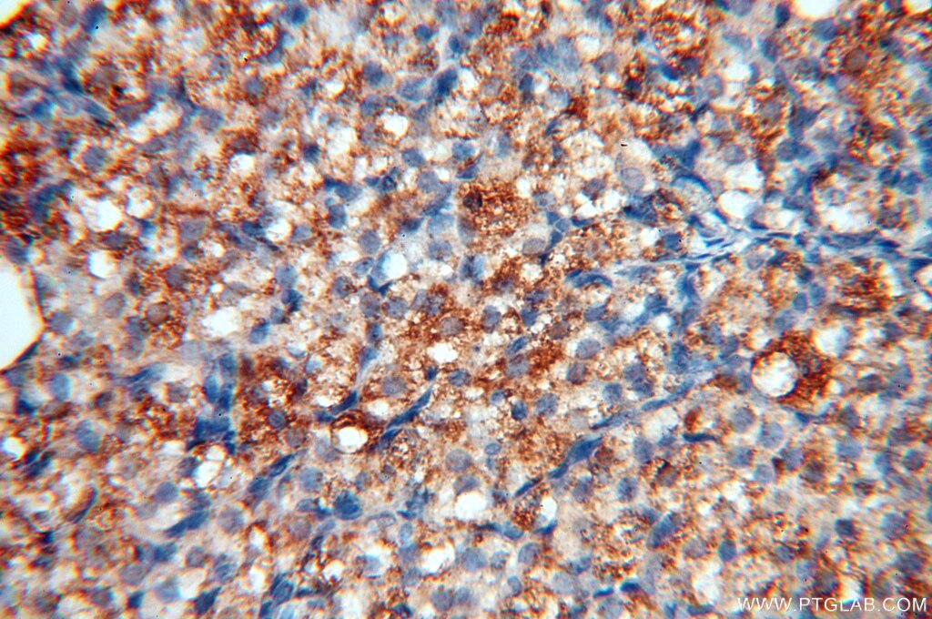 Immunohistochemistry (IHC) staining of human ovary tissue using MAN1A2 Polyclonal antibody (14049-1-AP)