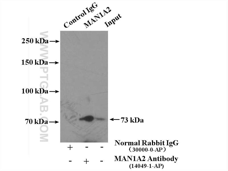 Immunoprecipitation (IP) experiment of human placenta tissue using MAN1A2 Polyclonal antibody (14049-1-AP)