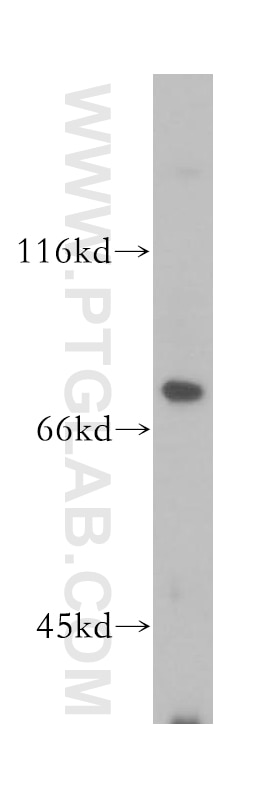 Western Blot (WB) analysis of human placenta tissue using MAN1A2 Polyclonal antibody (14049-1-AP)