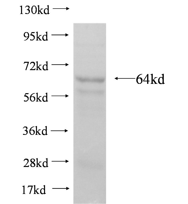 MAN1A2 fusion protein Ag5240 SDS-PAGE