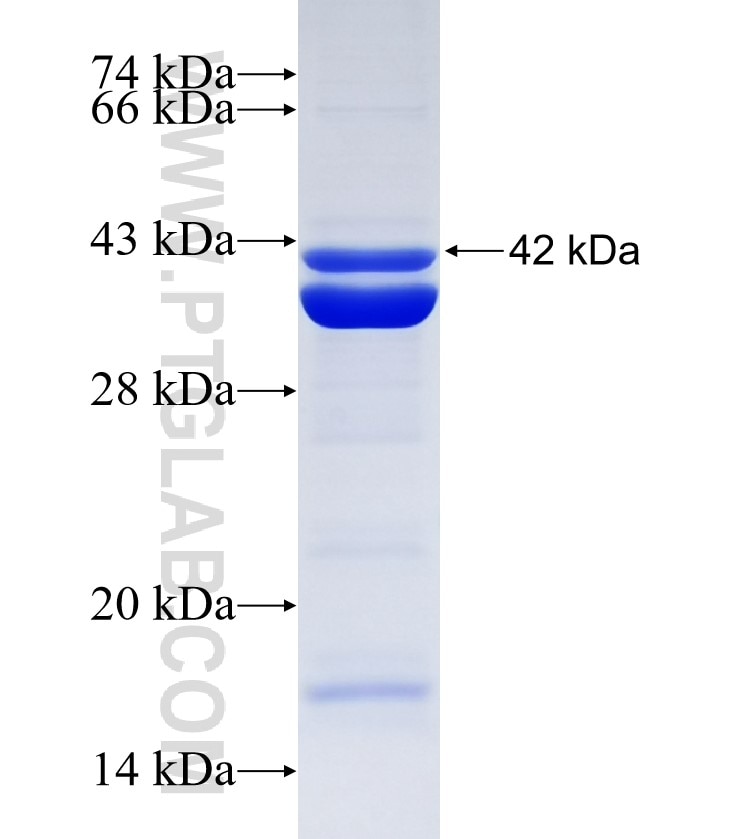 MAN1B1 fusion protein Ag28302 SDS-PAGE