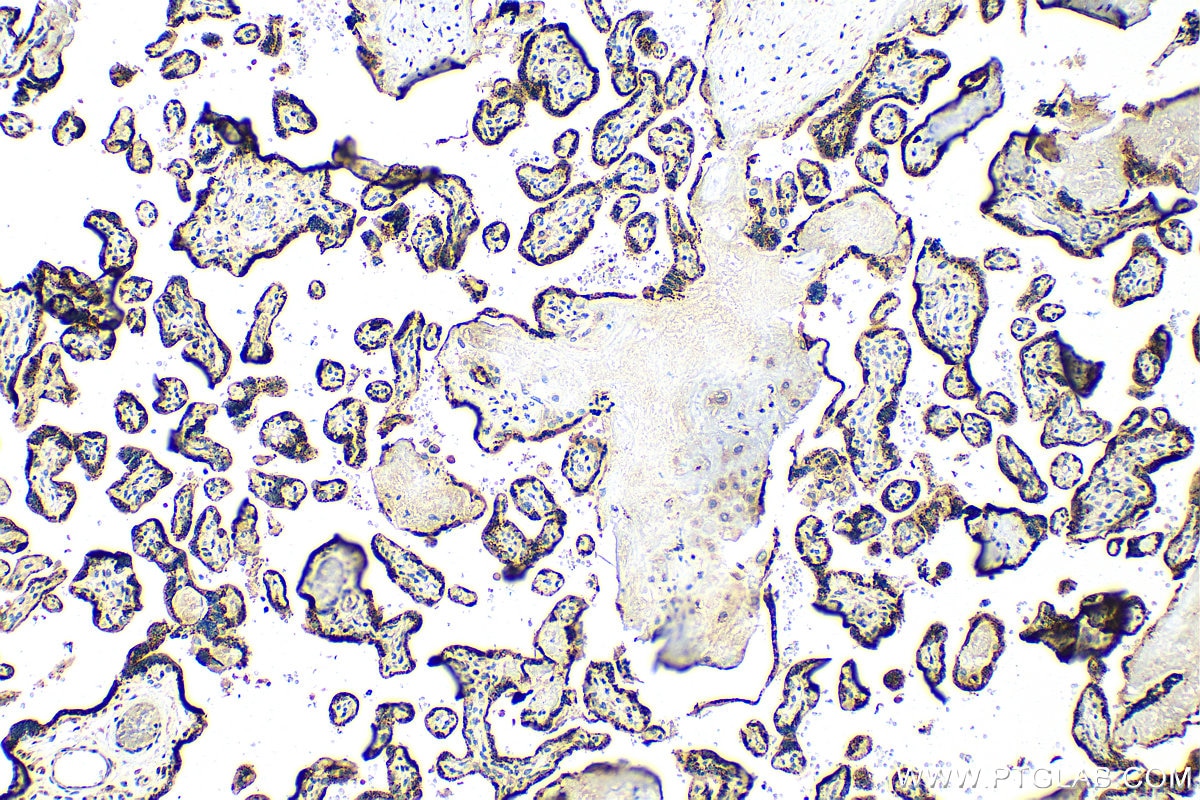 IHC staining of human placenta using 25921-1-AP