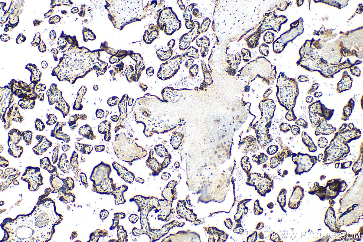 Immunohistochemistry (IHC) staining of human placenta tissue using MAN1C1 Polyclonal antibody (25921-1-AP)