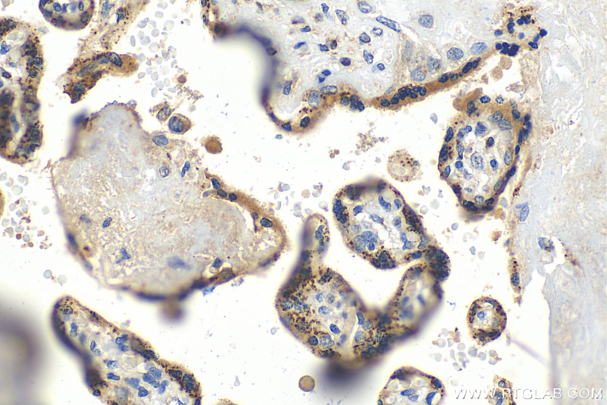 Immunohistochemistry (IHC) staining of human placenta tissue using MAN1C1 Polyclonal antibody (25921-1-AP)