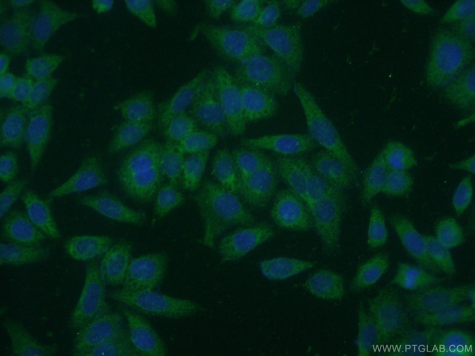 Immunofluorescence (IF) / fluorescent staining of HeLa cells using MAN2A1 Polyclonal antibody (21132-1-AP)