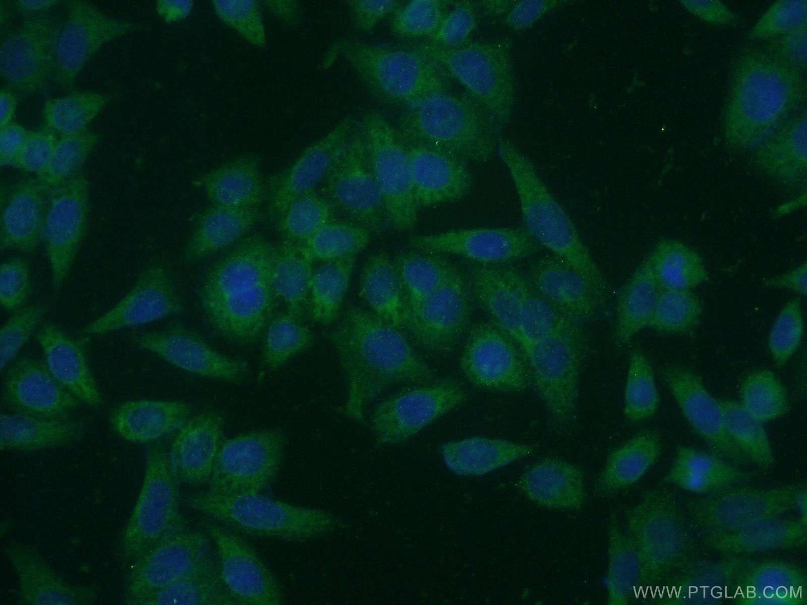 IF Staining of HeLa using 21132-1-AP