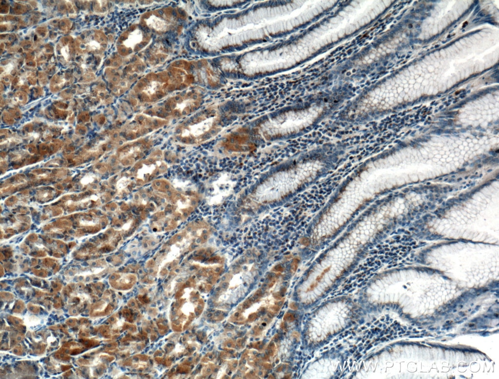 Immunohistochemistry (IHC) staining of human stomach tissue using MAN2A1 Polyclonal antibody (21132-1-AP)