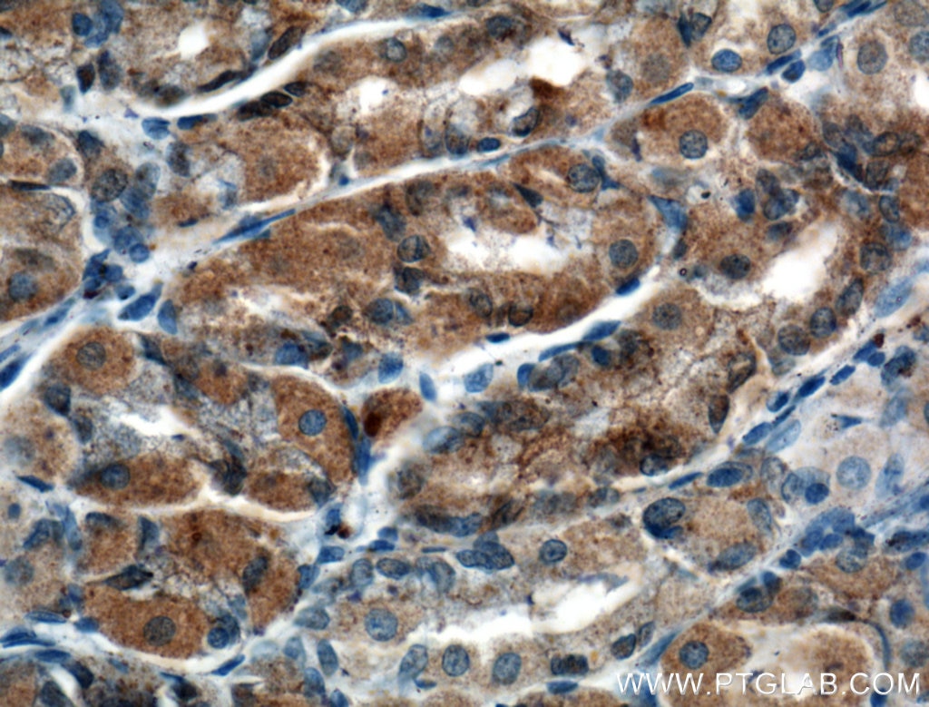 Immunohistochemistry (IHC) staining of human stomach tissue using MAN2A1 Polyclonal antibody (21132-1-AP)