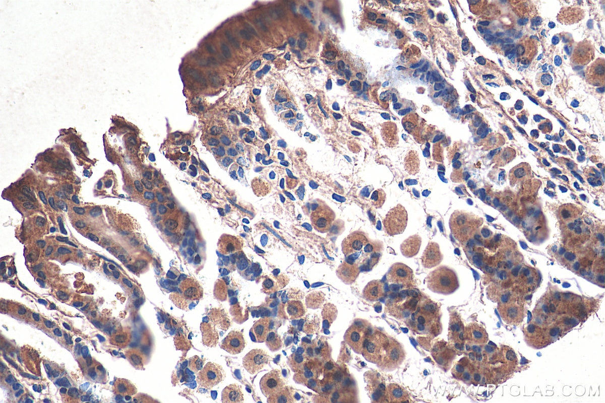 Immunohistochemistry (IHC) staining of mouse stomach tissue using MAN2A1 Polyclonal antibody (21132-1-AP)