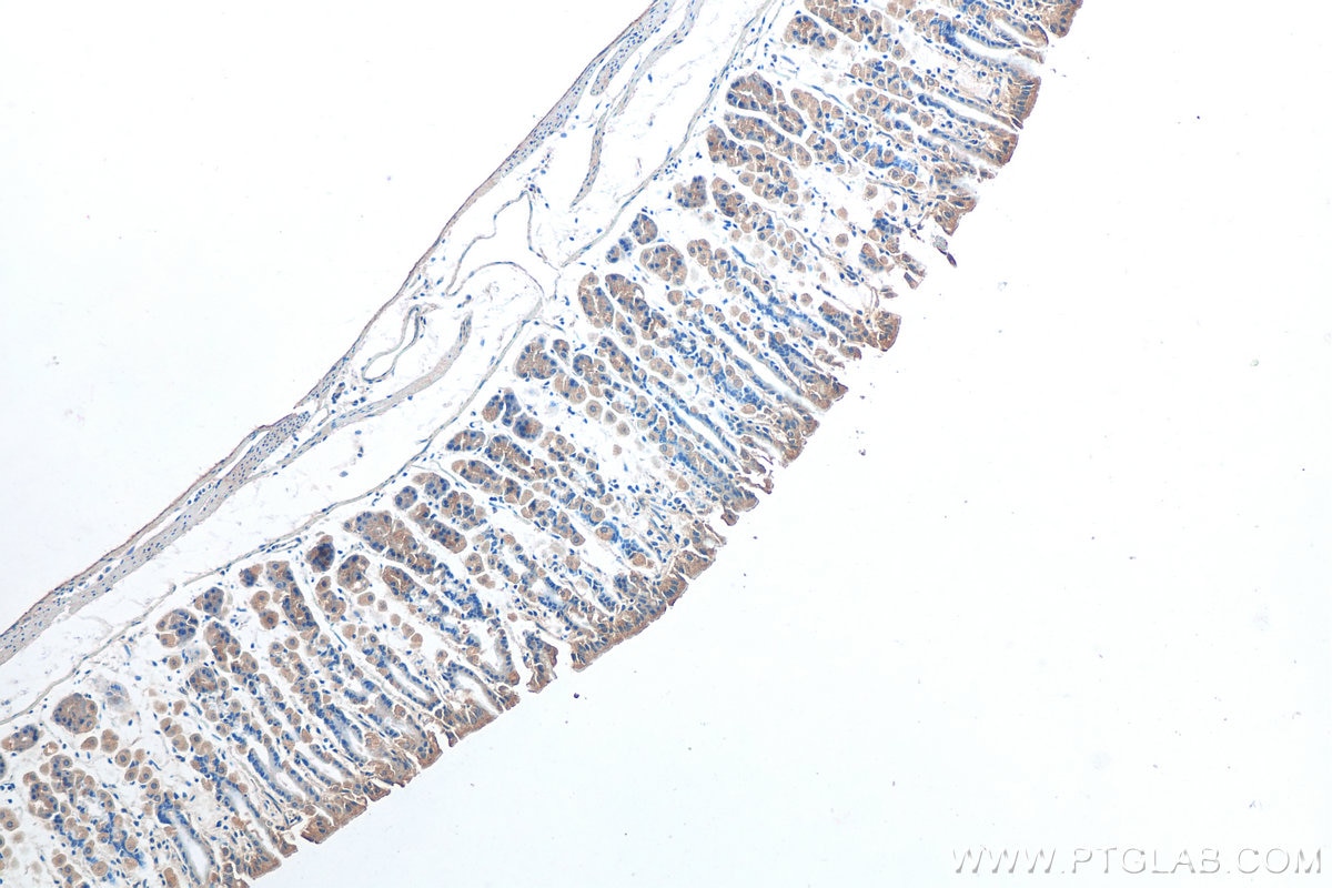 Immunohistochemistry (IHC) staining of mouse stomach tissue using MAN2A1 Polyclonal antibody (21132-1-AP)
