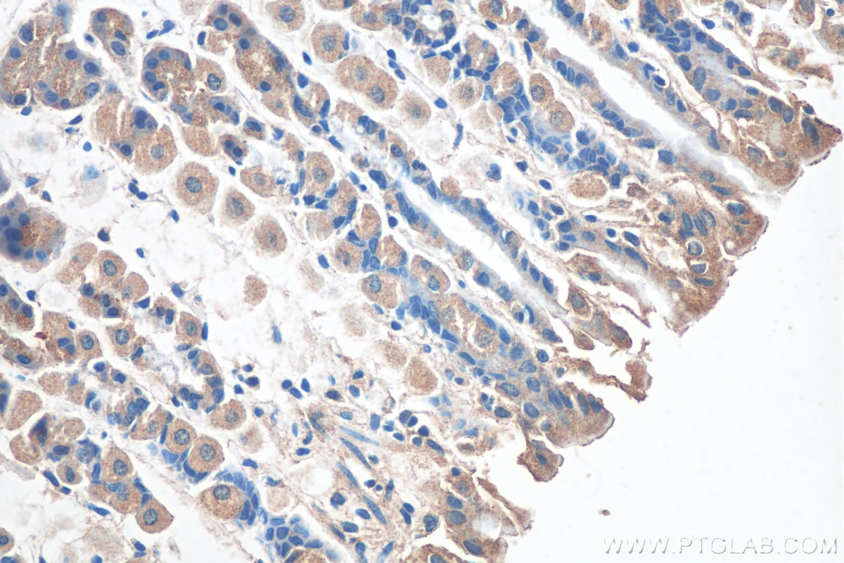 Immunohistochemistry (IHC) staining of mouse stomach tissue using MAN2A1 Polyclonal antibody (21132-1-AP)