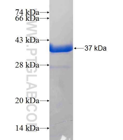 MAN2B1 fusion protein Ag24420 SDS-PAGE