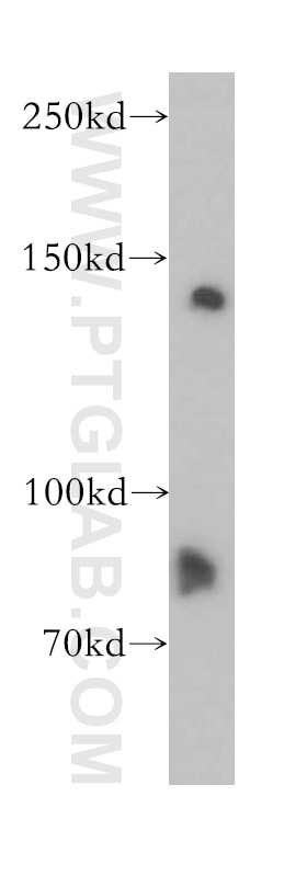 Western Blot (WB) analysis of mouse lung tissue using MAN2B2 Polyclonal antibody (17697-1-AP)