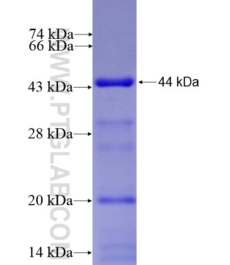 MAN2B2 fusion protein Ag11952 SDS-PAGE