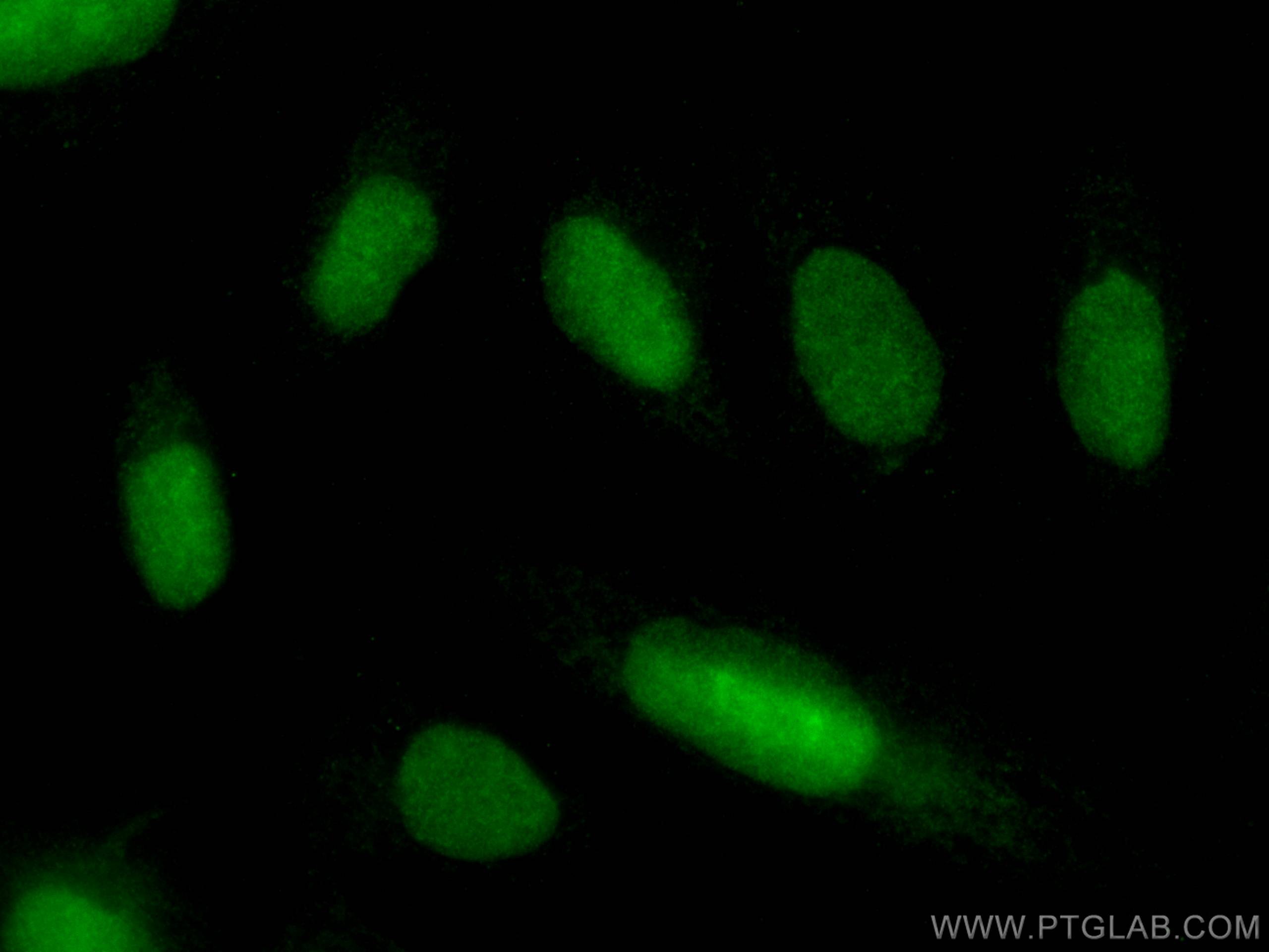 Immunofluorescence (IF) / fluorescent staining of U2OS cells using MANBAL Polyclonal antibody (16028-1-AP)