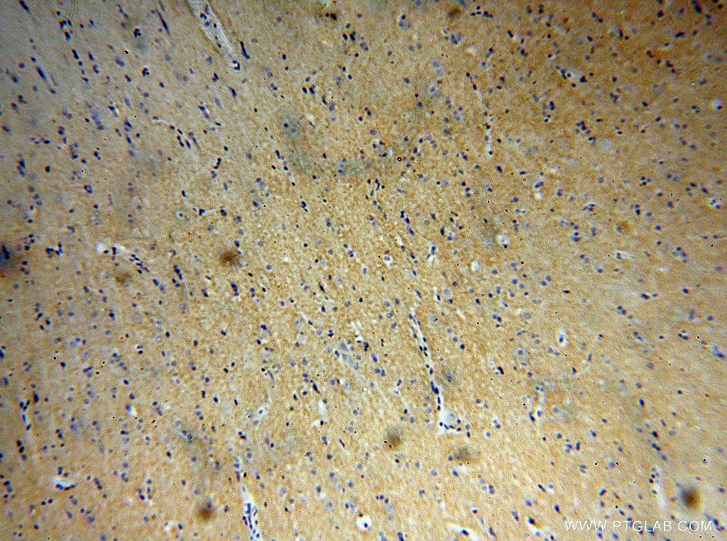 Immunohistochemistry (IHC) staining of human brain tissue using MANBAL Polyclonal antibody (16028-1-AP)