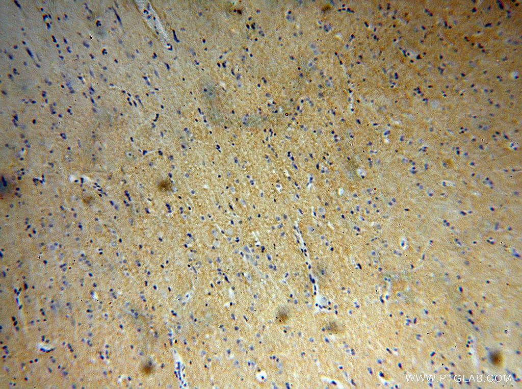 IHC staining of human brain using 16028-1-AP