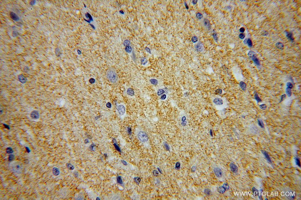 IHC staining of human brain using 16028-1-AP