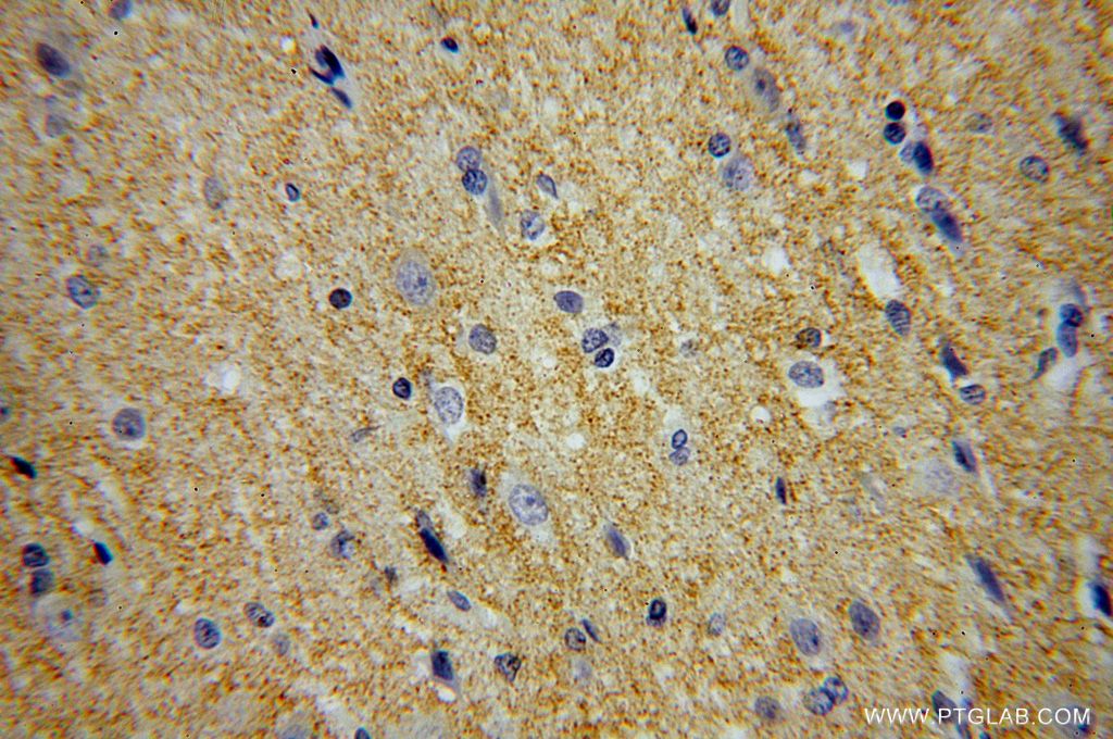 Immunohistochemistry (IHC) staining of human brain tissue using MANBAL Polyclonal antibody (16028-1-AP)