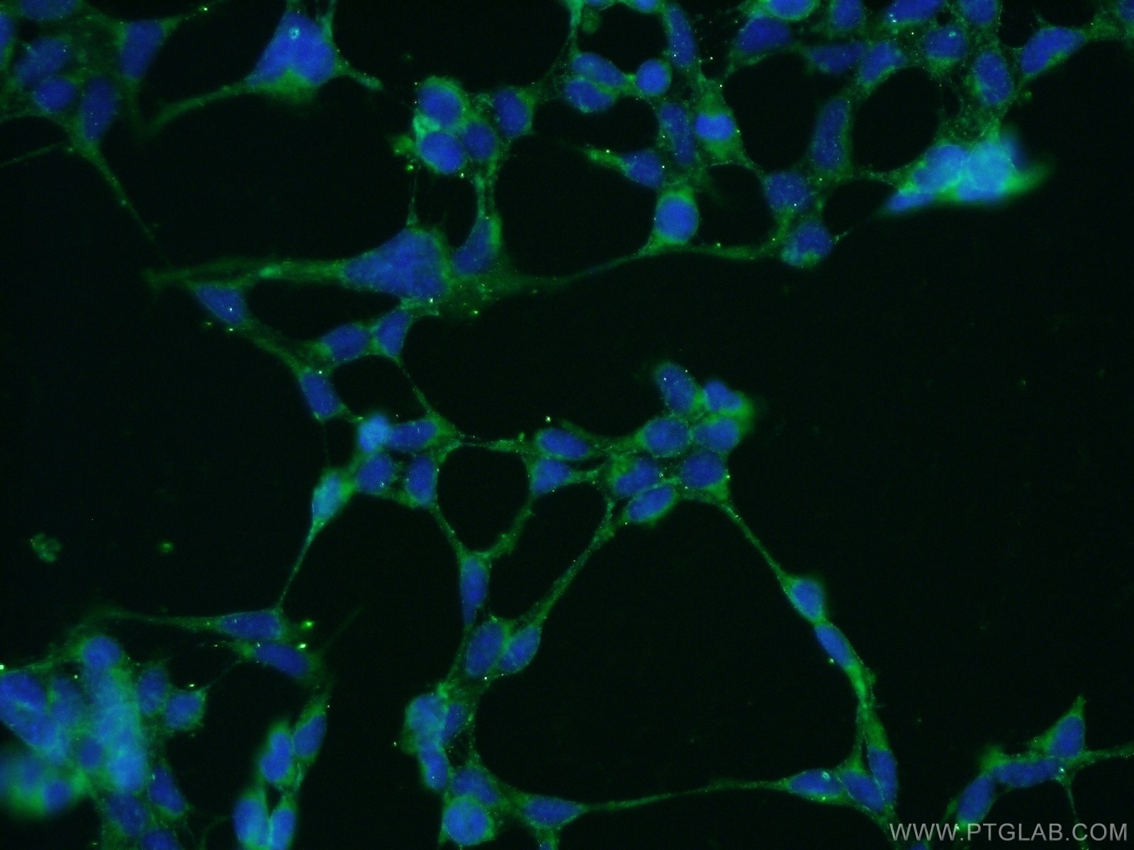 Immunofluorescence (IF) / fluorescent staining of HEK-293 cells using MANEA Polyclonal antibody (21296-1-AP)