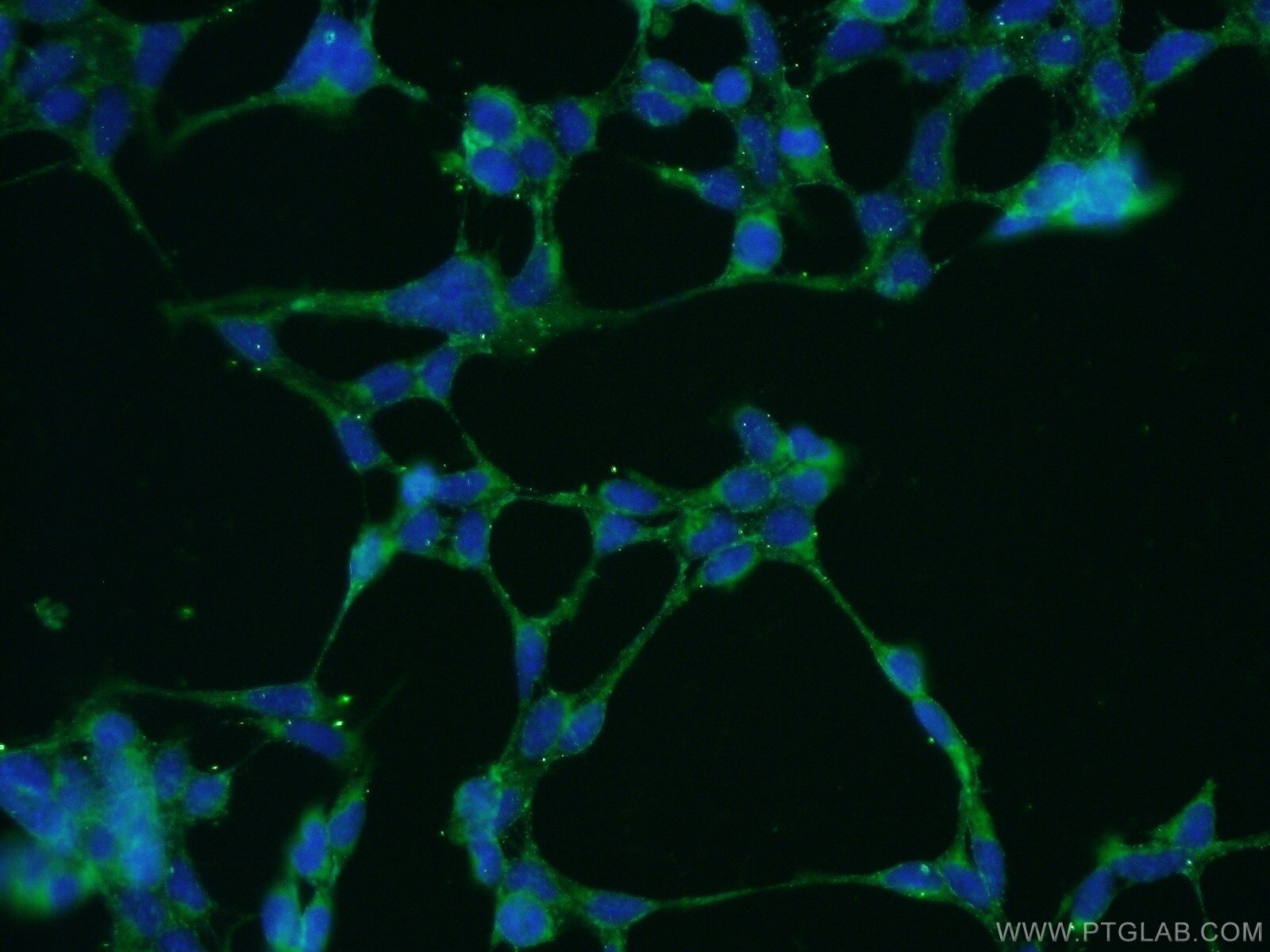 IF Staining of HEK-293 using 21296-1-AP