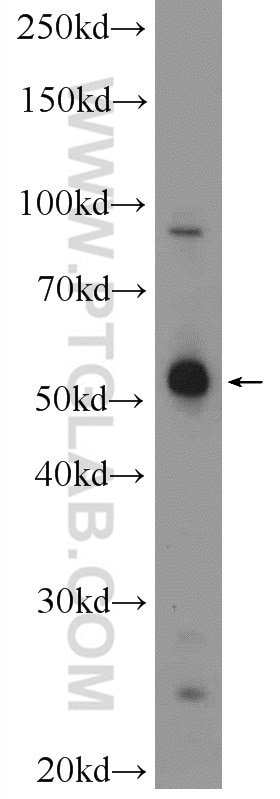 Western Blot (WB) analysis of HEK-293 cells using MANEA Polyclonal antibody (21296-1-AP)