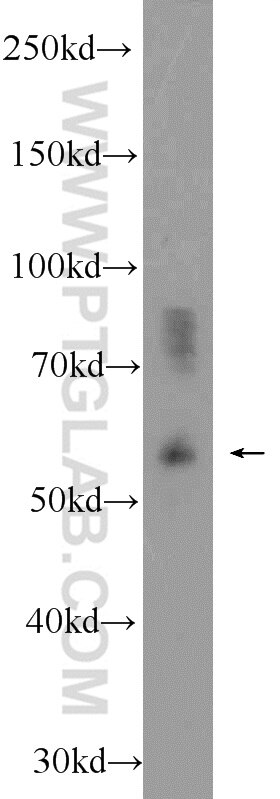 Western Blot (WB) analysis of mouse kidney tissue using MANEA Polyclonal antibody (21296-1-AP)