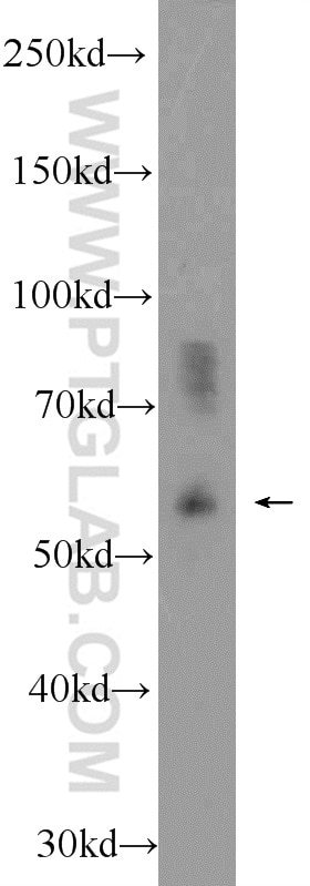 WB analysis of mouse kidney using 21296-1-AP