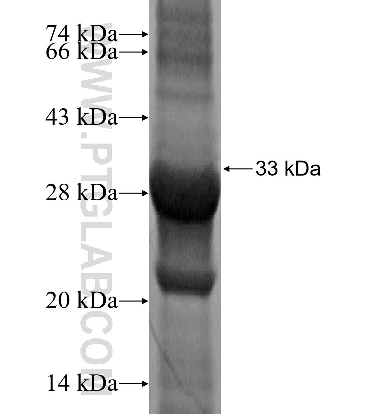 MANEA fusion protein Ag15847 SDS-PAGE