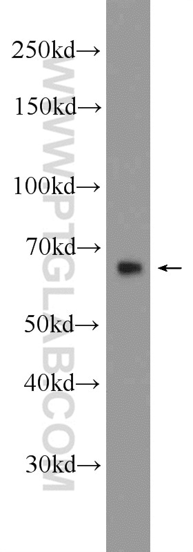 Western Blot (WB) analysis of human skeletal muscle tissue using MANSC1 Polyclonal antibody (25586-1-AP)